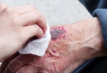 Basınç Yaraları ve Bakımı