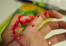 Kanama Riski Bakım Planı