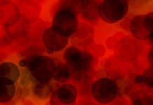 Periferik Doku Perfüzyonunda Bozulma