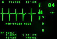Ritm Bozukluğu Hemşirelik Bakımı