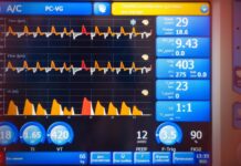 Spontane Ventilasyon